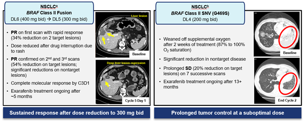 Patient scans in NSCLC showing reduction in disease.