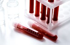 Blood samples