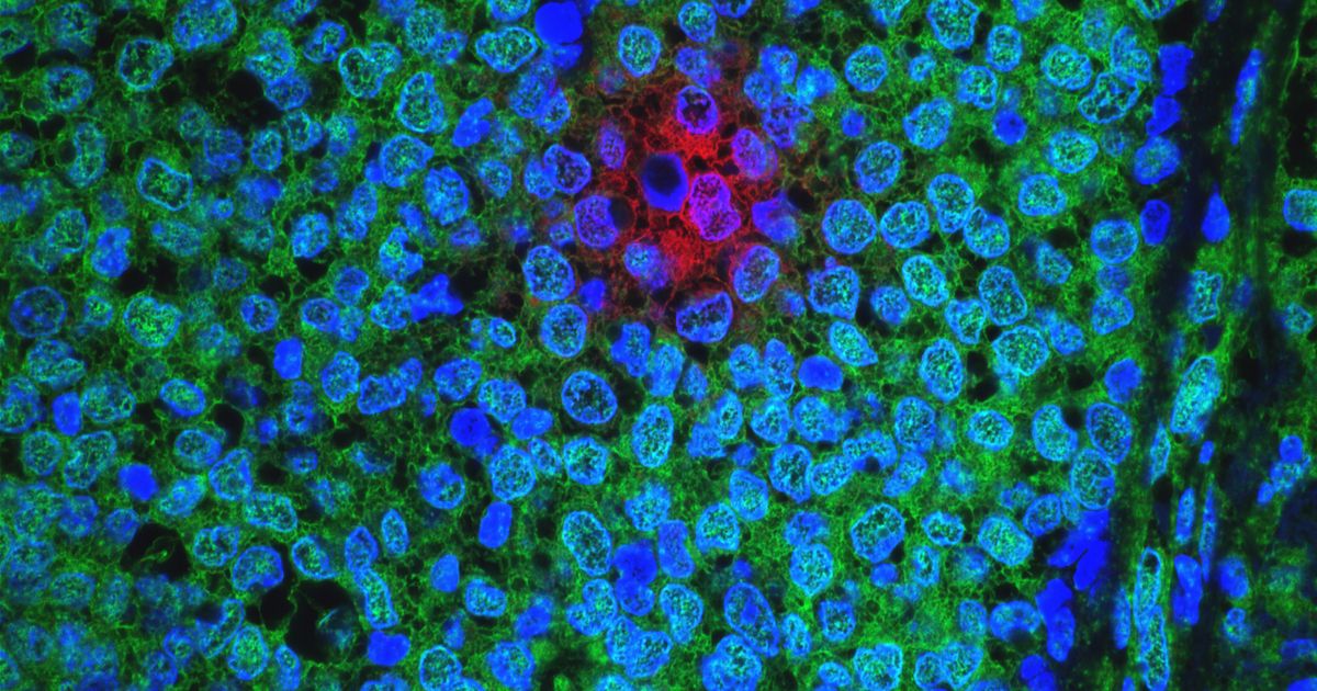 Ataraxis AI Aims to Address Gaps in Molecular Testing with AI Digital ...