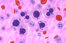 Multiple myeloma cells